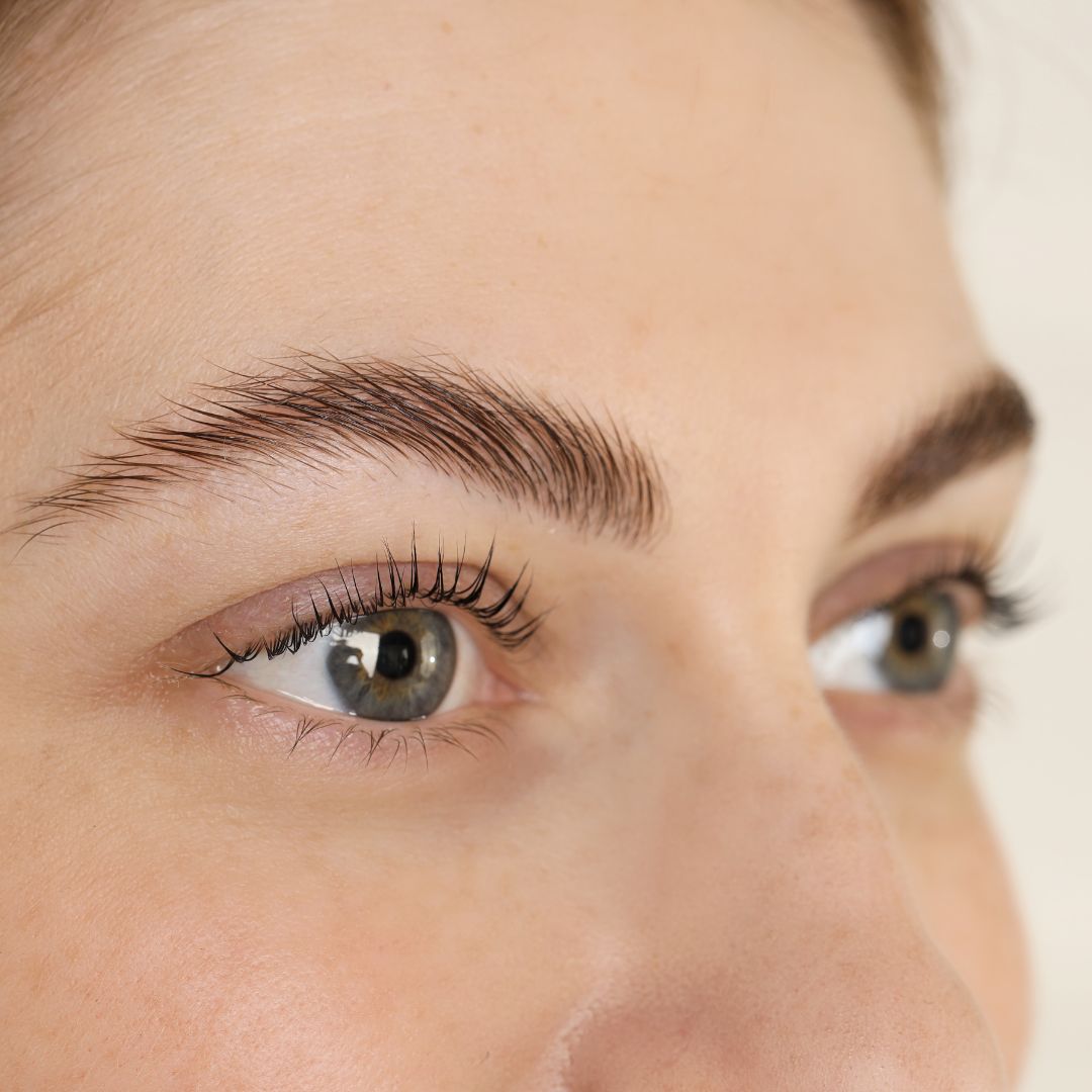 Can a Brow Lift Open the Eyes Without Changing Your Expression?